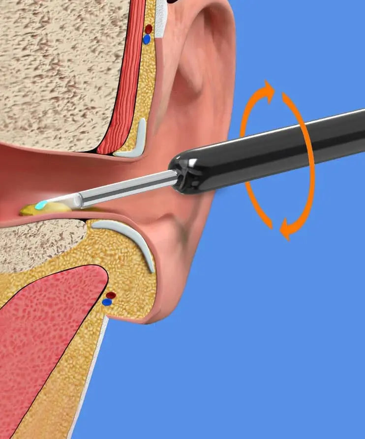 Smart Ear Cleaner with 1296P HD Camera, Wireless Earwax Removal WiFi Endoscope, Safe Inspection Intelligent Temperature Control, Black Wholesale Hub