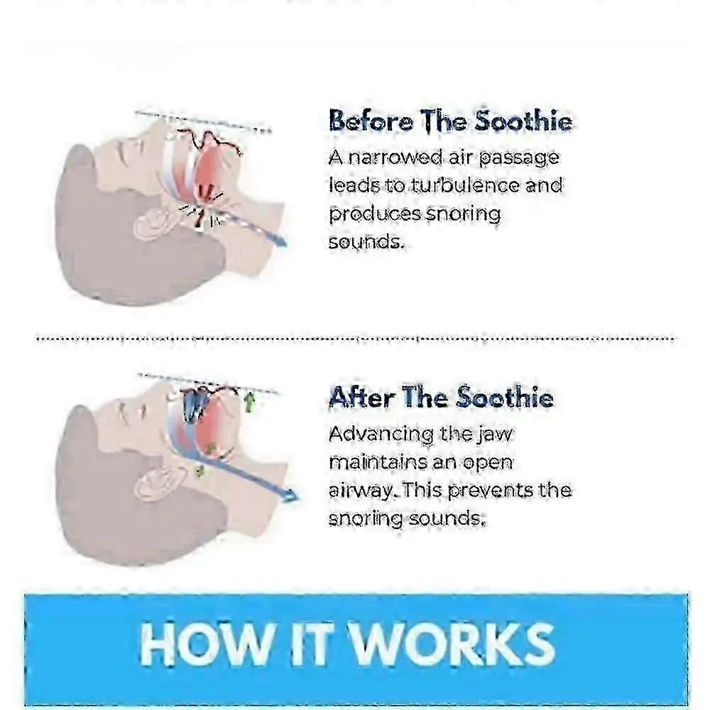 Honex Anti-Snoring Mouthpiece - Quite Night Device, Adjustable Jaw Wholesale Hub