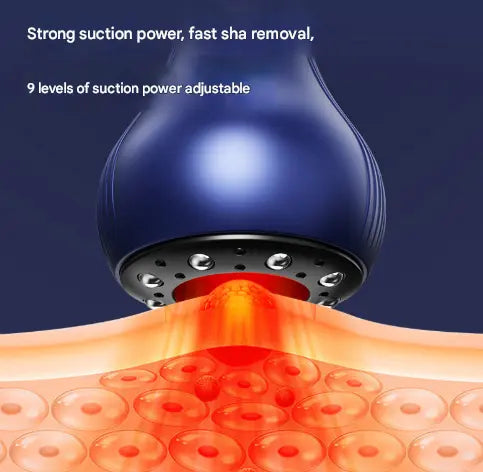 Blue Electric Meridian Scraping Massager with Air Release Valve - Full Body Suction Therapy, 16.6x8.4cm Wholesale Hub