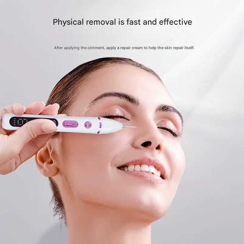 Professional Electric Mole & Dark Spot Remover Pen - Advanced Plasma Ion Technology for Seamless Skin Tag & Freckle Removal (Purple) Wholesale Hub
