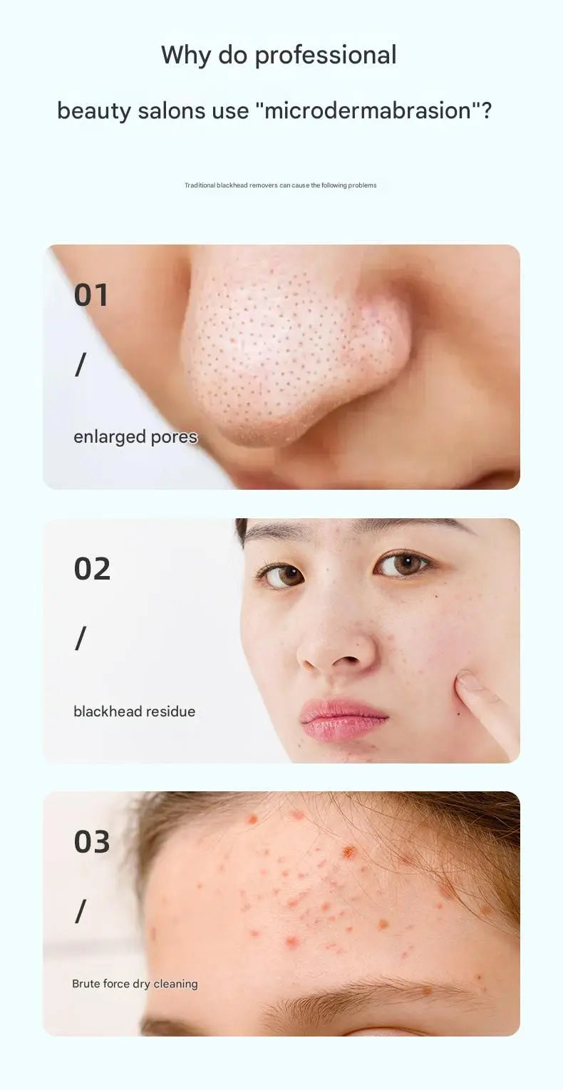 White Heated Micro-Bubble Blackhead Remover Vacuum Pore Cleaner - 46C Hot Compress Electric Water Cycle Facial Cleansing Device with 6 Suction Heads 3 Modes Wholesale Hub