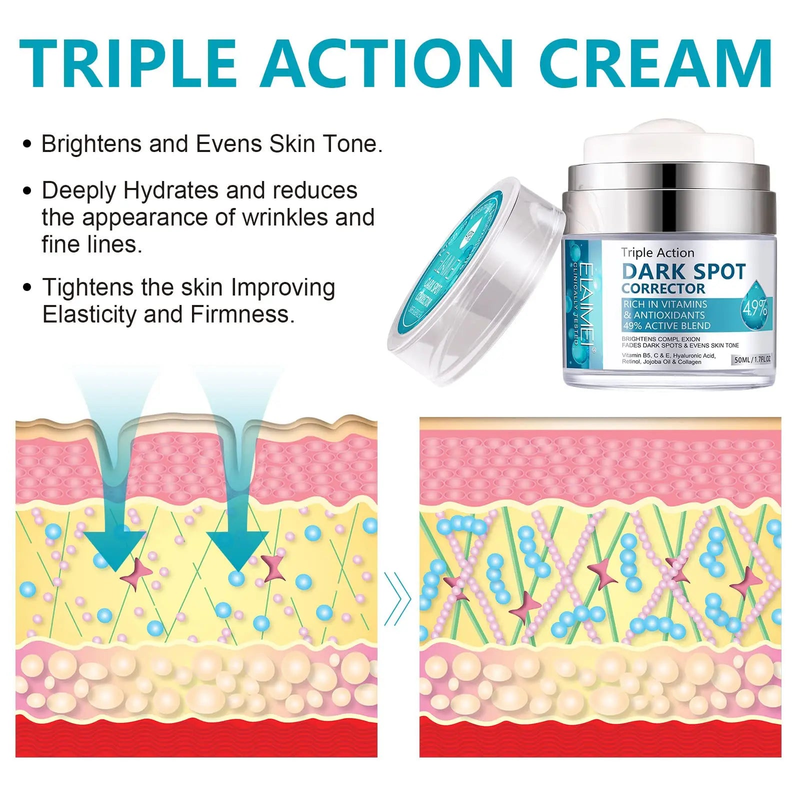 Age Spot Cream | Fades Freckles & Skin Pigmentation | Dark Spot Corrector for Even Skin Tone Wholesale Hub